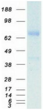 Coomassie blue staining of purified TF protein.